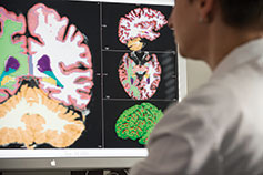 Doctor looking at brain scans. Link to Life Stage Gift Planner Ages 60-70 Situations.
